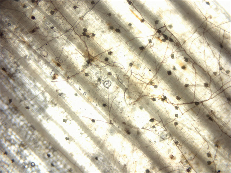New insights on take-all root rot Gaeumannomyces