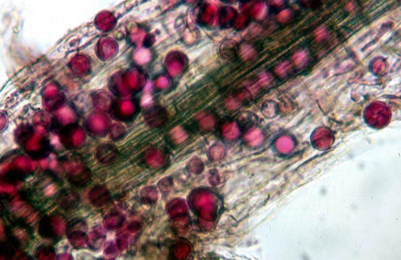 Pythium root rot Q&A Pythium oospores